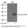 Phospho-CCNE1 (Thr395) Antibody