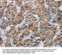 Rabbit anti-human IFNGR2 polyclonal antibody