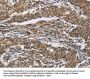 Rabbit anti-human IFNGR2 polyclonal antibody