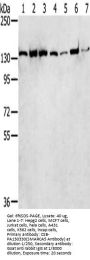 SMARCA5 Antibody