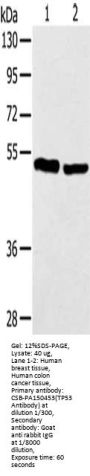 TP53 Antibody