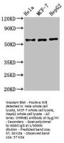 CHRNB1 Antibody