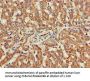 CHRNB1 Antibody