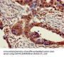 CHRNB1 Antibody