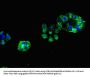 CHRNB1 Antibody