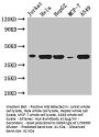 HLA-B Antibody