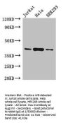 HLA-C Antibody
