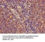 HLA-C Antibody