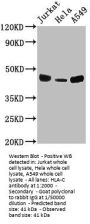 HLA-C Antibody