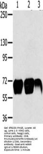 MMP9 Antibody