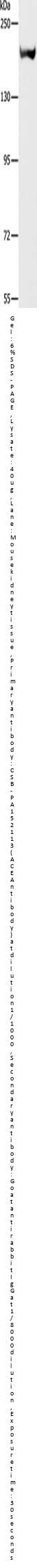 ACE Antibody