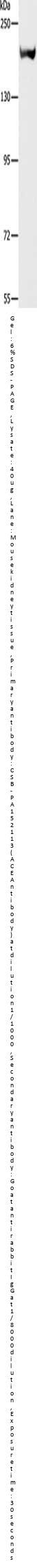 ACE Antibody