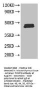 Rabbit anti-human Forkhead box protein P3 polyclonal Antibody