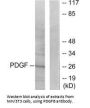 PDGFB Antibody