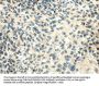 Rabbit anti-human SMYD2 polyclonal antibody