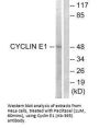 CCNE1 (Ab-395) Antibody