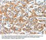AFAP1 Antibody