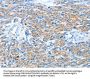 AFAP1 Antibody