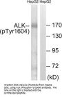 Phospho-ALK (Tyr1604) Antibody