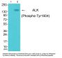 Phospho-ALK (Tyr1604) Antibody