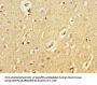 ATG5 Antibody
