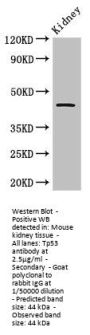 Tp53 Antibody