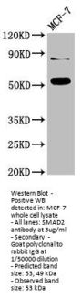 SMAD2 Antibody