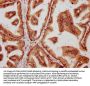 SMAD2 Antibody