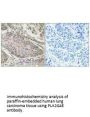 PLA2G4E Antibody