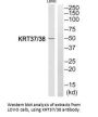 KRT38/KRT37 Antibody