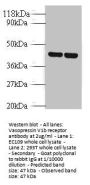 Avpr1b Antibody