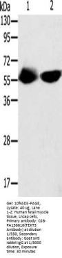 Rabbit anti-human TEKT3 polyclonal antibody