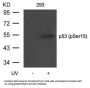 Phospho-TP53 (Ser15) Antibody