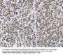 ADNP Antibody