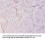 HPRT1 Antibody