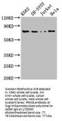 PRKCB Antibody
