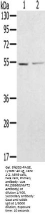 NMT2 Antibody