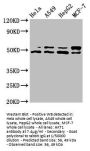 AKT1 Antibody