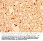 AKT1 Antibody