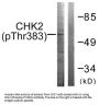 Phospho-CHEK2 (Thr383) Antibody