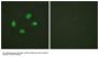 Phospho-CHEK2 (Thr383) Antibody
