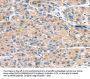 MASP2 Antibody