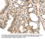 MASP2 Antibody