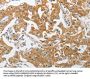 PIK3R3 Antibody