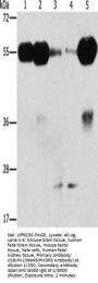 PIK3R3 Antibody