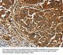 CEACAM5 Antibody