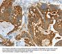 CEACAM5 Antibody