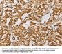 ARHGEF5 Antibody
