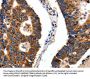 ITGB6 Antibody