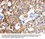ITGB6 Antibody